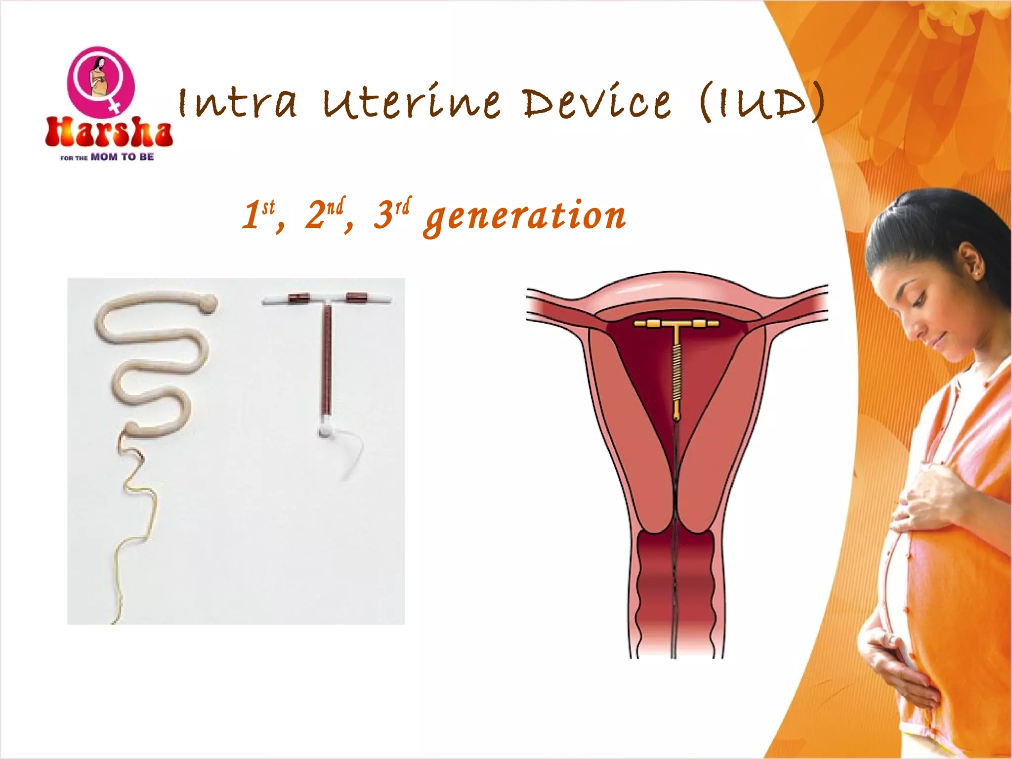 Intra Uterine Device (IUD)
1st
, 2nd
, 3rd
generation
 