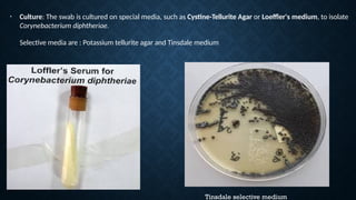 Tinsdale selective medium
• Culture: The swab is cultured on special media, such as Cystine-Tellurite Agar or Loeffler's medium, to isolate
Corynebacterium diphtheriae.
Selective media are : Potassium tellurite agar and Tinsdale medium
 
