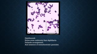 Diphtheroid:
Stains more uniformly than diphtheria
Palisade arrangement
And absence of metachromatic granules.
 