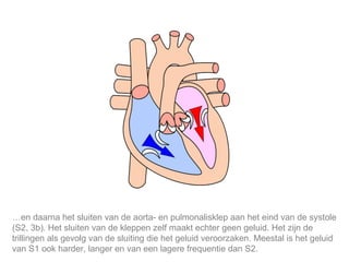 Mijn lijfstijl is mijn keuze. … en daarna het sluiten van de aorta- en pulmonalisklep aan het eind van de systole (S2, 3b). Het sluiten van de kleppen zelf maakt echter geen geluid. Het zijn de trillingen als gevolg van de sluiting die het geluid veroorzaken. Meestal is het geluid van S1 ook harder, langer en van een lagere frequentie dan S2.  