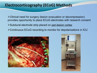 Electrocorticography (ECoG) Methods Clinical need for surgery (lesion evacuation or decompression) provides opportunity to place ECoG electrodes with research consent Subdural electrode strip placed on  peri-lesion cortex Continuous ECoG recording to monitor for depolarizations in ICU 