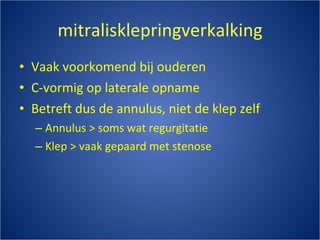 mitralisklepringverkalking Vaak voorkomend bij ouderen C-vormig op laterale opname Betreft dus de annulus, niet de klep zelf Annulus > soms wat regurgitatie Klep > vaak gepaard met stenose 