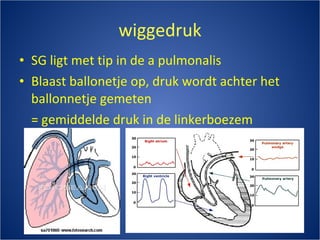 wiggedruk SG ligt met tip in de a pulmonalis Blaast ballonetje op, druk wordt achter het ballonnetje gemeten = gemiddelde druk in de linkerboezem 