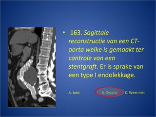   163.  Sagittale reconstructie van een CT-aorta welke is gemaakt ter controle van een stentgraft . Er is sprake van een type I endolekkage. A. Juist B. Onjuist C. Weet niet 