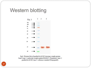 Western blotting
47
 
