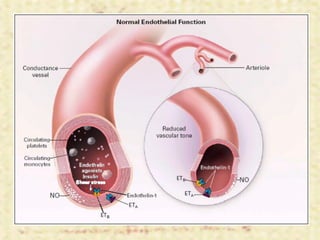 Hipertensión Arterial