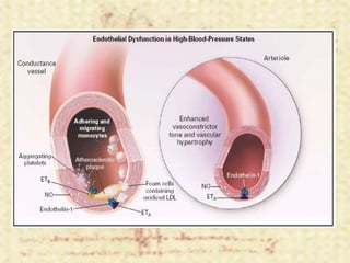 Hipertensión Arterial