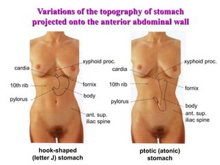 pylorus
pylorus
10th rib
10th rib
cardia cardia
xyphoid proc.
fornix
fornix
body
body
ant. sup.
iliac spine
hook-shaped
(letter J) stomach
ptotic (atonic)
stomach
Variations of the topography of stomach
projected onto the anterior abdominal wall
ant. sup.
iliac spine
xyphoid proc.
 
