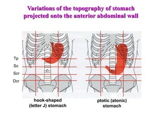 Tp
Sc
Scr
Dcr
Variations of the topography of stomach
projected onto the anterior abdominal wall
hook-shaped
(letter J) stomach
ptotic (atonic)
stomach
 