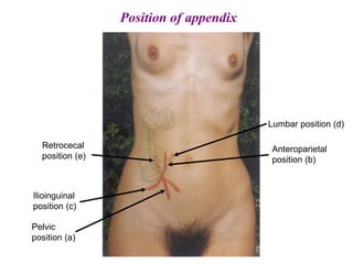 Pelvic
position (a)
Ilioinguinal
position (c)
Lumbar position (d)
Anteroparietal
position (b)
Retrocecal
position (e)
Position of appendix
 