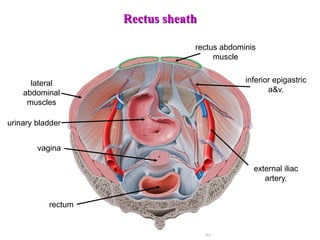 urinary bladder
vagina
rectum
rectus abdominis
muscle
inferior epigastric
a&v.
lateral
abdominal
muscles
external iliac
artery.
Rectus sheath
 
