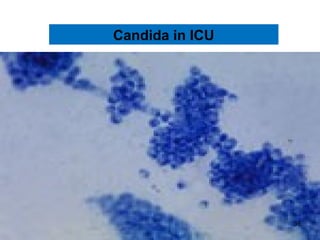 Candida in ICU
36
 
