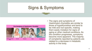 Signs & Symptoms
• The signs and symptoms of
Hashimoto's thyroiditis are similar to
those of hypothyroidism and tend to
be mild and non-specific, making
them easily mistaken for signs of
aging or other medical conditions. As
the condition progresses, symptoms
become more apparent. The majority
of complaints reported by patients are
related to a decrease in metabolic
activity in the body.
6
 