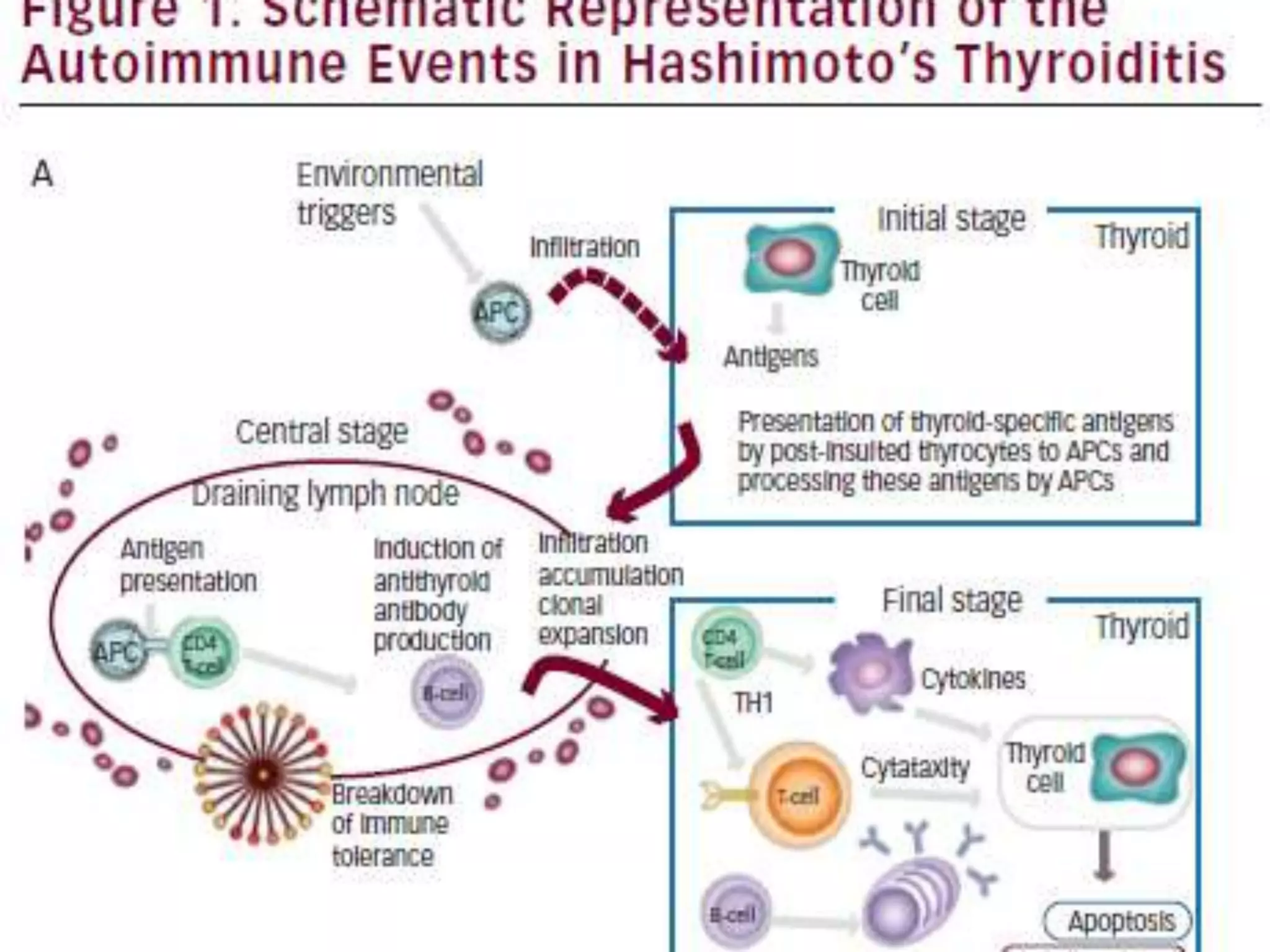 hashimotosthyroiditis-170825171347.pdf