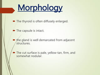 Hashimoto's thyroiditis by aslammatania | PPTX