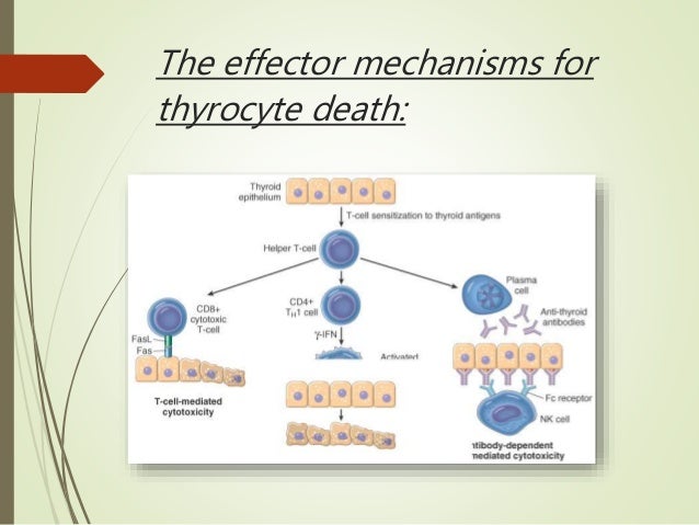  Hashimoto s thyroiditis by aslammatania