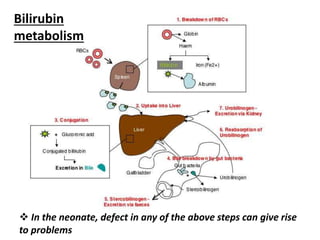  In the neonate, defect in any of the above steps can give rise
to problems
Bilirubin
metabolism
 