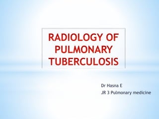 Dr Hasna E
JR 3 Pulmonary medicine
 