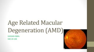 Age Related Macular
Degeneration (AMD)
HASSAN IQBAL
GM-20-148
 