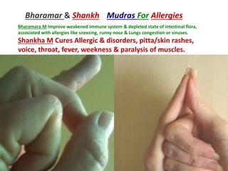 Bharamar & Shankh Mudras For Allergies
Bharamara M Improve weakened immune system & depleted state of intestinal flora,
associated with allergies like sneezing, runny nose & Lungs congestion or sinuses.
Shankha M Cures Allergic & disorders, pitta/skin rashes,
voice, throat, fever, weekness & paralysis of muscles.
 