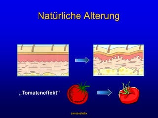 swissestetixUnvermeidlich – Alterungsprozess der HautZellaufbau der jungen HautZellaufbau der älteren HautOberhaut (Epidermis)Lederhaut(Dermis)