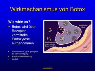 Seit 2002 offiziell zur Faltenbehandlung registriert als „Vistabel“swissestetixMimik und Falten
