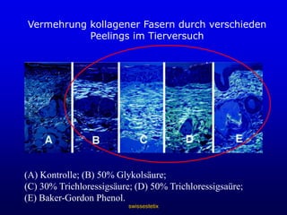 swissestetixWangenfüllevorhernachher