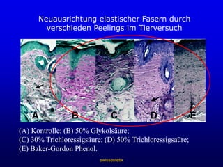 swissestetixZornesfaltennachhervorher