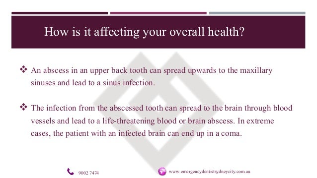 Abcessed tooth brain infection