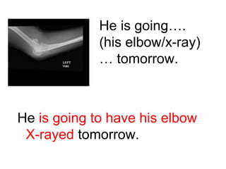 He is going….
(his elbow/x-ray)
… tomorrow.

He is going to have his elbow
X-rayed tomorrow.

 