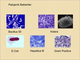 Patojenik Bakteriler
Bacillus 55 Kolera
E.Coli Hepatitus B Gram Positive
 