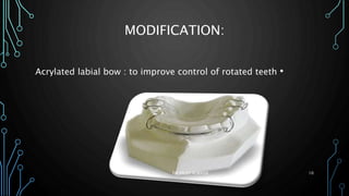 MODIFICATION:
•Acrylated labial bow : to improve control of rotated teeth
DR.SALEH ALWADIE 10
 