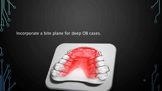 Incorporate a bite plane for deep OB cases.
DR.SALEH ALWADIE 12
 
