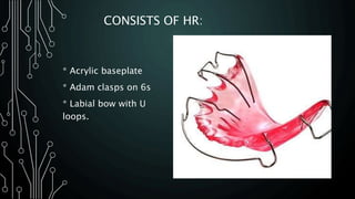 CONSISTS OF HR:
* Acrylic baseplate
* Adam clasps on 6s
* Labial bow with U
loops.
DR.SALEH ALWADIE 8
 