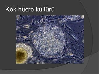 Kök hücre kültürü

 