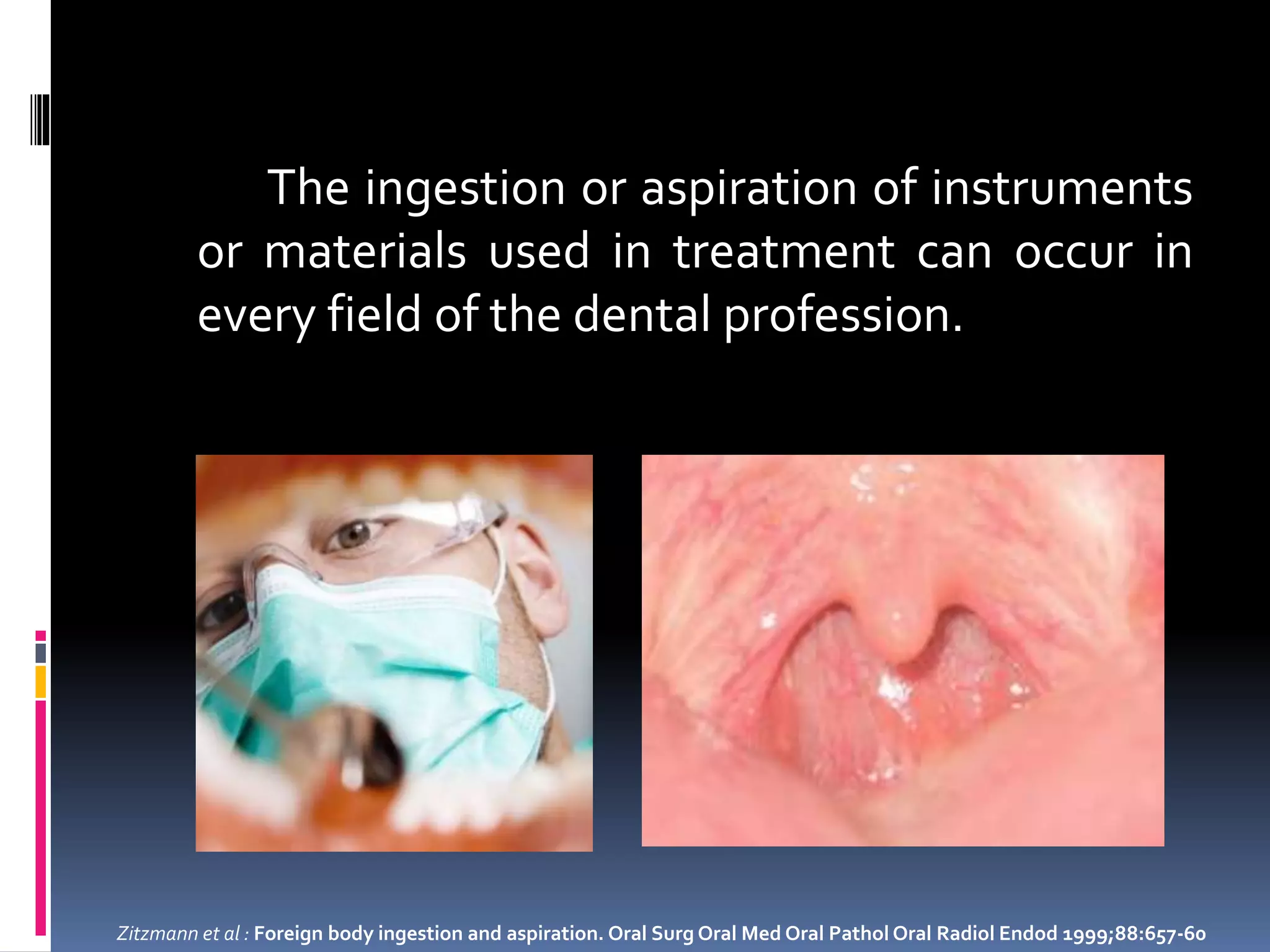 Hazards of swallowing orthodontic appliances | PPTX