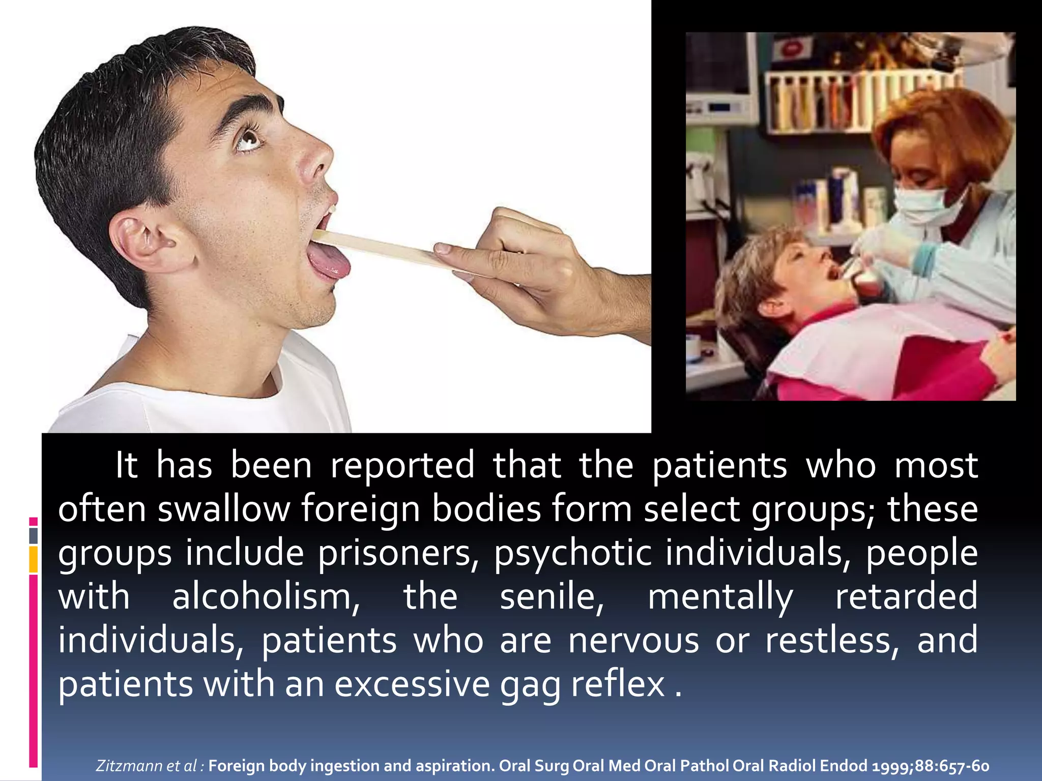 Hazards of swallowing orthodontic appliances PPT