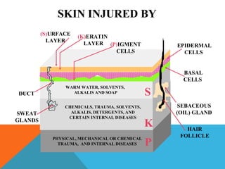 HAIR
FOLLICLE
SEBACEOUS
(OIL) GLAND
BASAL
CELLS
EPIDERMAL
CELLS
(S)URFACE
LAYER
(K)ERATIN
LAYER (P)IGMENT
CELLS
DUCT
SWEAT
GLANDS
S
K
P
SKIN INJURED BY
WARM WATER, SOLVENTS,
ALKALIS AND SOAP
CHEMICALS, TRAUMA, SOLVENTS,
ALKALIS, DETERGENTS, AND
CERTAIN INTERNAL DISEASES
PHYSICAL, MECHANICAL OR CHEMICAL
TRAUMA, AND INTERNAL DISEASES
 