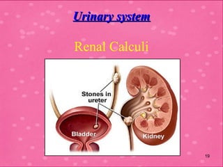 complications / Hazards of immobility