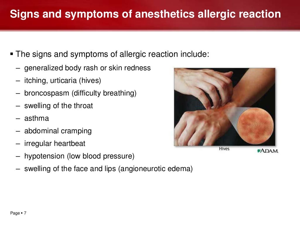 Hazards of local anesthesia