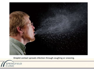 Droplet contact spreads infection through coughing or sneezing.
 