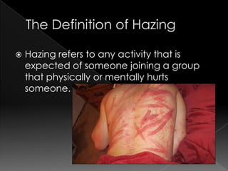 hazing