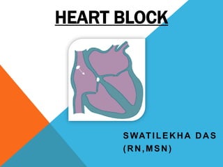 HEART BLOCK
SWATILEKHA DAS
(RN,MSN)
 