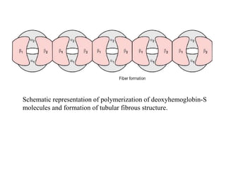 Schematic representation of polymerization of deoxyhemoglobin-S
molecules and formation of tubular fibrous structure.
 