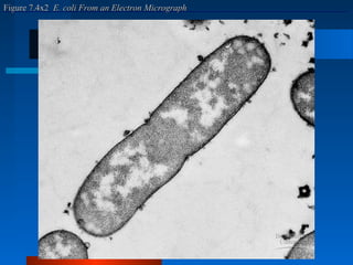 FFiigguurree 77..44xx22 EE.. ccoollii FFrroomm aann EElleeccttrroonn MMiiccrrooggrraapphh 
 