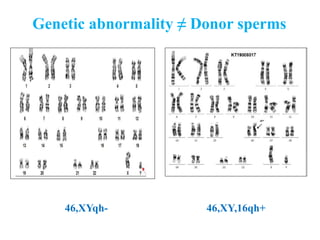 Genetic abnormality ≠ Donor sperms
46,XYqh- 46,XY,16qh+
 