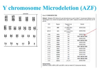 Y chromosome Microdeletion (AZF)
 