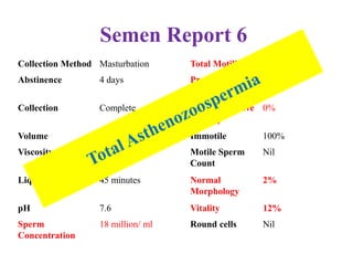 Semen Report 6
Collection Method Masturbation Total Motility 0%
Abstinence 4 days Progressive
Motility
0%
Collection Complete Non progressive
Motility
0%
Volume 2 ml Immotile 100%
Viscosity Normal Motile Sperm
Count
Nil
Liquefaction Time 45 minutes Normal
Morphology
2%
pH 7.6 Vitality 12%
Sperm
Concentration
18 million/ ml Round cells Nil
 