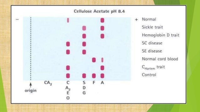 Hemoglobin C Disease Electrophoresis Hb elect
