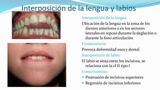 Interposición de la lengua y labios 
Interposición de la lengua 
Ubicación de la lengua en la zona de los 
dientes anteriores o en los sectores 
laterales en reposo durante la deglución o 
durante la fono articulación 
Consecuencia: 
Provoca deformidad osea y dental 
Interposición de labio: 
El labio se sitúa entre los incisivos, se 
relaciona con la cl II tipo I 
Consecuencias: 
 Protrusión de incisivos superiores 
 Regresión de incisivos inferiores 
 